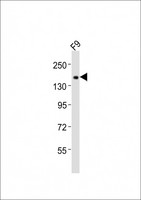 LCX / TET1 Antibody - Anti-Tet1 Antibody at 1:2000 dilution + F9 whole cell lysates Lysates/proteins at 20 ug per lane. Secondary Goat Anti-Rabbit IgG, (H+L), Peroxidase conjugated at 1/10000 dilution Predicted band size : 219 kDa Blocking/Dilution buffer: 5% NFDM/TBST.