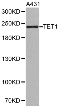 LCX / TET1 Antibody - Western blot analysis of extracts of A-431 cells, using TET1 antibody. The secondary antibody used was an HRP Goat Anti-Rabbit IgG (H+L) at 1:10000 dilution. Lysates were loaded 25ug per lane and 3% nonfat dry milk in TBST was used for blocking.