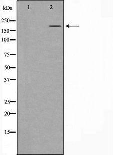 LCX / TET1 Antibody - Western blot analysis of extracts of A431 cells using TET1 antibody. The lane on the left is treated with the antigen-specific peptide.