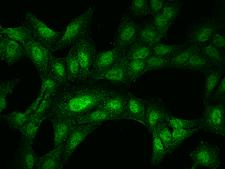 LCX / TET1 Antibody - Immunofluorescence staining of TET1 in U2OS cells. Cells were fixed with 4% PFA, permeabilzed with 0.1% Triton X-100 in PBS, blocked with 10% serum, and incubated with rabbit anti-Human TET1 polyclonal antibody (dilution ratio 1:200) at 4°C overnight. Then cells were stained with the Alexa Fluor 488-conjugated Goat Anti-rabbit IgG secondary antibody (green). Positive staining was localized to Nucleus.