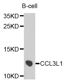 LD78 / CCL3L1 Antibody - Western blot analysis of extracts of B cells.