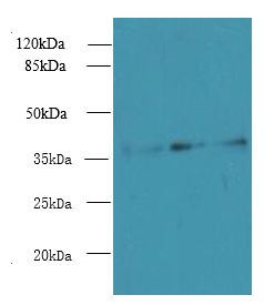 LDAH Antibody - Western blot. All lanes: LDAH antibody at 8 ug/ml. Lane 1: HeLa whole cell lysate. Lane 2: Jurkat whole cell lysate. Lane 3: A431 whole cell lysate. Secondary Goat polyclonal to Rabbit IgG at 1:10000 dilution. Predicted band size: 37 kDa. Observed band size: 37 kDa.