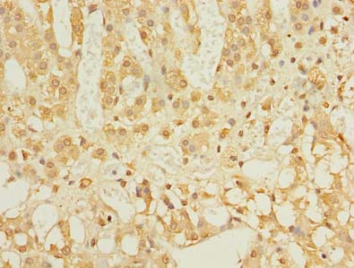 LDAH Antibody - Immunohistochemistry of paraffin-embedded human adrenal gland tissue using antibody at dilution of 1:100.