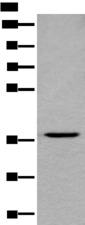 LDAH Antibody - Western blot analysis of HEPG2 cell lysate  using LDAH Polyclonal Antibody at dilution of 1:600