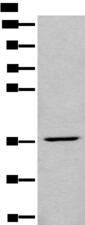 LDAH Antibody - Western blot analysis of HEPG2 cell lysate  using LDAH Polyclonal Antibody at dilution of 1:650