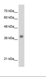 LDB1 / CLIM2 Antibody - HepG2 Cell Lysate.  This image was taken for the unconjugated form of this product. Other forms have not been tested.