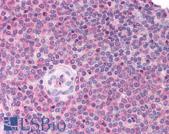 LDB1 / CLIM2 Antibody - Anti-LDB1 antibody IHC of human spleen. Immunohistochemistry of formalin-fixed, paraffin-embedded tissue after heat-induced antigen retrieval. Antibody concentration 5 ug/ml.  This image was taken for the unconjugated form of this product. Other forms have not been tested.
