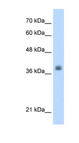 LDB1 / CLIM2 Antibody - LDB1 antibody Western blot of HepG2 cell lysate. This image was taken for the unconjugated form of this product. Other forms have not been tested.