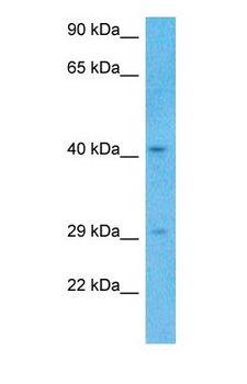 LDB1 / CLIM2 Antibody - Western blot of LDB1 Antibody with human Fetal Kidney lysate.  This image was taken for the unconjugated form of this product. Other forms have not been tested.