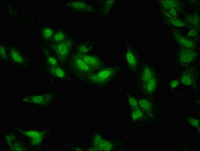 LDB1 / CLIM2 Antibody - Immunofluorescent analysis of Hela cells at a dilution of 1:100 and Alexa Fluor 488-congugated AffiniPure Goat Anti-Rabbit IgG(H+L)
