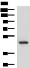 LDB1 / CLIM2 Antibody - Western blot analysis of 293T cell lysate  using LDB1 Polyclonal Antibody at dilution of 1:1000