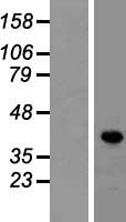 LDB1 / CLIM2 Protein - Western validation with an anti-DDK antibody * L: Control HEK293 lysate R: Over-expression lysate