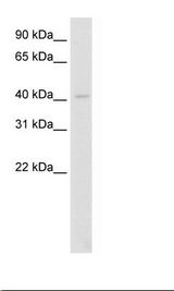 LDB2 Antibody - Fetal Lung Lysate.  This image was taken for the unconjugated form of this product. Other forms have not been tested.