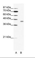 LDB2 Antibody - A: Marker, B: HepG2 Cell Lysate.  This image was taken for the unconjugated form of this product. Other forms have not been tested.