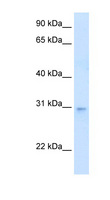 LDB3 / ZASP Antibody - LDB3 antibody ARP41588_T100-NP_001073584-LDB3(LIM domain binding 3) Antibody Western blot of Fetal Heart lysate.  This image was taken for the unconjugated form of this product. Other forms have not been tested.
