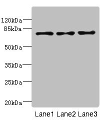LDB3 / ZASP Antibody - Western blot All Lanes: LDB3 antibody at 3.21ug/ml Lane 1: Raji whole cell lysate Lane 2: MCF7 whole cell lysate Lane 3: A431 whole cell lysate Secondary Goat polyclonal to rabbit IgG at 1/10000 dilution Predicted band size: 78,67,51,43,36,31,79 kDa Observed band size: 77 kDa