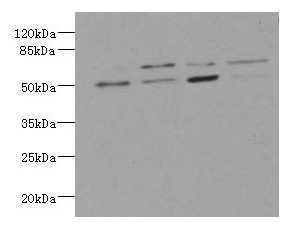LDB3 / ZASP Antibody - Western blot All lanes: LDB3 antibody at 3.21ug/ml Lane 1 : Hela whole cell lysate Lane 2 : Raji whole cell lysate Lane 3 : MCF-7 whole cell lysate Lane 4 : A431 whole cell lysate Secondary Goat polyclonal to rabbit IgG at 1/10000 dilution Predicted band size: 78, 67, 51, 43, 36, 31, 79 kDa Observed band size: 67, 51 kDa