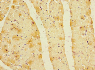 LDB3 / ZASP Antibody - Immunohistochemistry of paraffin-embedded human heart tissue at dilution 1:100