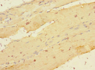 LDB3 / ZASP Antibody - Immunohistochemistry of paraffin-embedded human skeletal muscle tissue at dilution 1:100