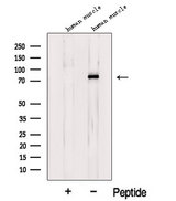 LDB3 / ZASP Antibody - Western blot analysis of extracts of human muscle tissue using LDB3 antibody. The lane on the left was treated with blocking peptide.