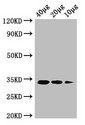 ldcA / Murein Tetrapeptide Carboxypeptidase Antibody - Western Blot Positive WB detected in: Rosseta bacteria lysate at 40µg, 20µg, 10µg All lanes: ldcA antibody at 1µg/ml Secondary Goat polyclonal to rabbit IgG at 1/50000 dilution predicted band size: 34 kDa observed band size: 34 kDa