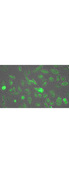 LDH / Lactate Dehydrogenase Antibody - Lactate Dehydrogenase Antibody-Immunofluorescence. Biotin conjugated anti-lactate dehydrogenase antibody was used to stain HeLa cells by immunofluorescence. HeLa cells were plated in 12 well plates, fixed for 5 min in 1:1 Methanol: Acetone, blocked with MB-071 (preservative free) for 15 min and stained 1 hr with antibody 1:200 in blocking buffer. Plate was washed 3X in PBS, and primary biotin conjugate was detected by DyLight 488 conjugated Streptavidin (S000-41 lot 21097) 1:10000 for 30 min. Well was washed 3X in PBS.