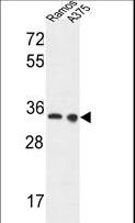 LDHA / LDH1 Antibody - LDHA Antibody western blot of Ramos,A375 cell line lysates (35 ug/lane). The LDHA antibody detected the LDHA protein (arrow).