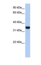 LDHA / LDH1 Antibody - 293T cell lysate. Antibody concentration: 1.0 ug/ml. Gel concentration: 12%.  This image was taken for the unconjugated form of this product. Other forms have not been tested.