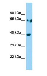 LDHA / LDH1 Antibody - LDHA / LDH A antibody Western Blot of Rat Stomach.  This image was taken for the unconjugated form of this product. Other forms have not been tested.
