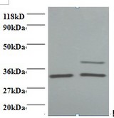 LDHA / LDH1 Antibody - Western blot of L-lactate dehydrogenase A chain antibody at 2 ug/ml. Lane 1: EC109 whole cell lysate. Lane 2: 293T whole cell lysate. Secondary: Goat polyclonal to Rabbit IgG at 1:15000 dilution. Predicted band size: 36.5 kDa. Observed band size: 32 kDa Additional bands at: 40 kDa. We are unsure as to the identity of this extra band.  This image was taken for the unconjugated form of this product. Other forms have not been tested.