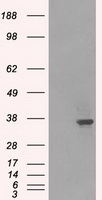LDHA / LDH1 Antibody - HEK293T cells were transfected with the pCMV6-ENTRY control (Left lane) or pCMV6-ENTRY LDHA (Right lane) cDNA for 48 hrs and lysed. Equivalent amounts of cell lysates (5 ug per lane) were separated by SDS-PAGE and immunoblotted with anti-LDHA.