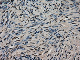 LDHA / LDH1 Antibody - Immunohistochemical staining of paraffin-embedded endometrium tissue using anti-LDHA mouse monoclonal antibody. (Dilution 1:50).
