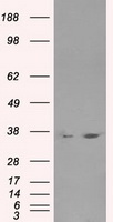 LDHA / LDH1 Antibody - HEK293T cells were transfected with the pCMV6-ENTRY control (Left lane) or pCMV6-ENTRY LDHA (Right lane) cDNA for 48 hrs and lysed. Equivalent amounts of cell lysates (5 ug per lane) were separated by SDS-PAGE and immunoblotted with anti-LDHA.