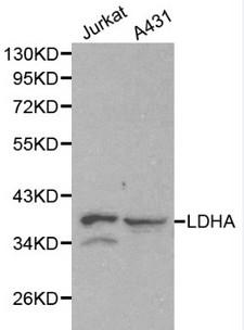 LDHA / LDH1 Antibody - Western blot of LDHA pAb in extracts from Jurkat and A431 cells.