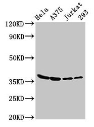 LDHA / LDH1 Antibody - Western Blot Positive WB detected in: Hela whole cell lysate, A375 whole cell lysate, Jurkat whole cell lysate, 293 whole cell lysate All lanes: LDHA antibody at 3µg/ml Secondary Goat polyclonal to rabbit IgG at 1/50000 dilution Predicted band size: 37, 31, 40, 27 kDa Observed band size: 37 kDa