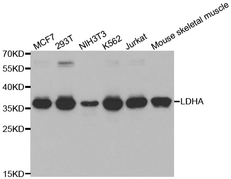 LDHA / LDH1 Antibody - Western blot analysis of extracts of various cell lines.