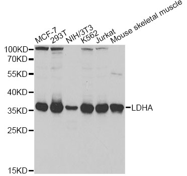 LDHA / LDH1 Antibody - Western blot analysis of extracts of various cell lines, using LDHA antibody at 1:1000 dilution. The secondary antibody used was an HRP Goat Anti-Rabbit IgG (H+L) at 1:10000 dilution. Lysates were loaded 25ug per lane and 3% nonfat dry milk in TBST was used for blocking.