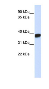 LDHA / LDH1 Antibody - LDHA antibody Western blot of Placenta lysate. This image was taken for the unconjugated form of this product. Other forms have not been tested.