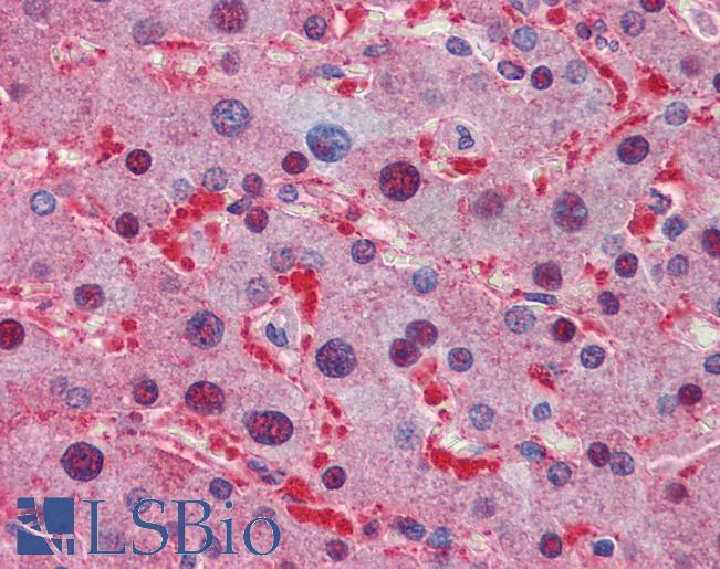 LDHA / LDH1 Antibody - Anti-LDHA antibody IHC of human liver. Immunohistochemistry of formalin-fixed, paraffin-embedded tissue after heat-induced antigen retrieval. Antibody concentration 2.5 ug/ml.  This image was taken for the unconjugated form of this product. Other forms have not been tested.