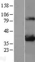 LDHA / LDH1 Protein - Western validation with an anti-DDK antibody * L: Control HEK293 lysate R: Over-expression lysate