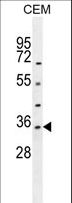 LDHAL6A Antibody - LDHAL6A Antibody western blot of CEM cell line lysates (35 ug/lane). The LDHAL6A antibody detected the LDHAL6A protein (arrow).