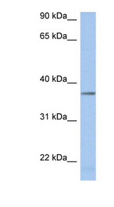 LDHAL6B Antibody - LDHAL6B antibody Western blot of Fetal Kidney lysate. This image was taken for the unconjugated form of this product. Other forms have not been tested.