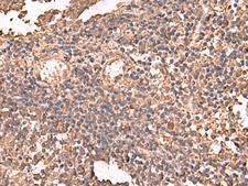 LDHAL6B Antibody - Immunohistochemistry of paraffin-embedded Human tonsil tissue  using LDHAL6B Polyclonal Antibody at dilution of 1:65(×200)