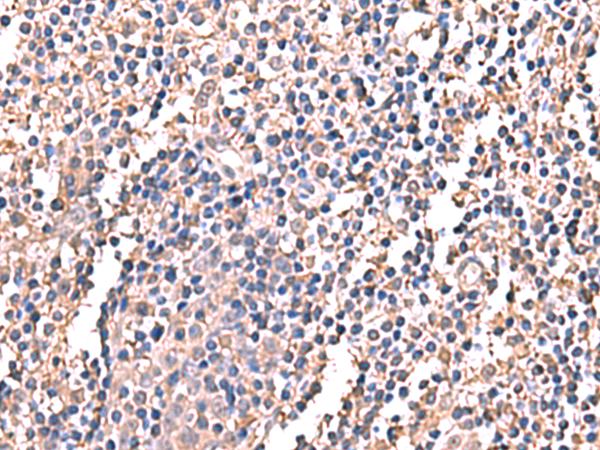 LDHAL6B Antibody - Immunohistochemistry of paraffin-embedded Human tonsil tissue  using LDHAL6B Polyclonal Antibody at dilution of 1:60(×200)