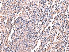 LDHAL6B Antibody - Immunohistochemistry of paraffin-embedded Human tonsil tissue  using LDHAL6B Polyclonal Antibody at dilution of 1:60(×200)