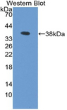 LDHB / Lactate Dehydrogenase B Antibody - Western blot of recombinant LDHB / LDH-B.