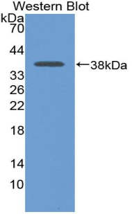 LDHB / Lactate Dehydrogenase B Antibody - Western blot of recombinant LDHB / LDH-B.