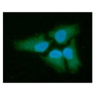 LDHB / Lactate Dehydrogenase B Antibody - ICC/IF analysis of LDHB in HeLa cells line, stained with DAPI (Blue) for nucleus staining and monoclonal anti-human LDHB antibody (1:100) with goat anti-mouse IgG-Alexa fluor 488 conjugate (Green).