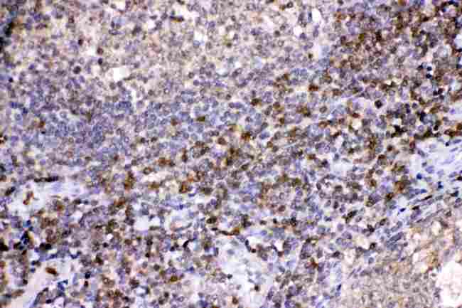 LDHB / Lactate Dehydrogenase B Antibody - LDHB was detected in paraffin-embedded sections of human tonsil tissues using rabbit anti- LDHB Antigen Affinity purified polyclonal antibody