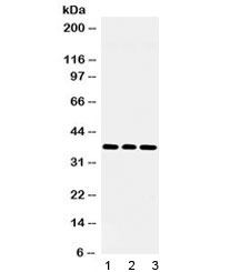 LDHB / Lactate Dehydrogenase B Antibody - Western blot testing of 1) rat brain, 2) mouse NIH 3T3 and 3) human U-2 OS lysate with LDHB antibody at 0.5ug/ml. Predicted/observed molecular weight ~36 kDa.
